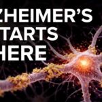 Alzheimer’s Linked to Brain Drain Blockage The REAL Cause of Alzheimer's in the Brain (Scientific Proof)