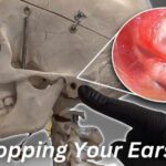 Ear Popping: What ENT Specialists Warn About What Happens When We Pop Our Ears