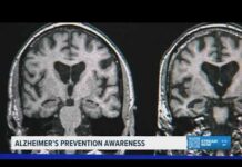 New report highlights habits that may help protect brain health