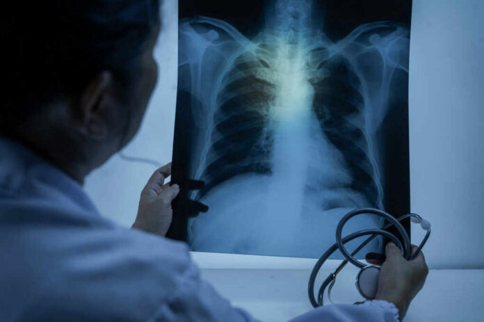 Doctor examining a chest X-ray with a stethoscope in hand