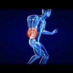 Ask the Expert: Back pain red flags