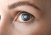 Laser Treatment Breakthrough Reverses Blindness Close-up view of a human eye showcasing the iris and eyelashes