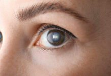 Laser Treatment Breakthrough Reverses Blindness Close-up view of a human eye showcasing the iris and eyelashes