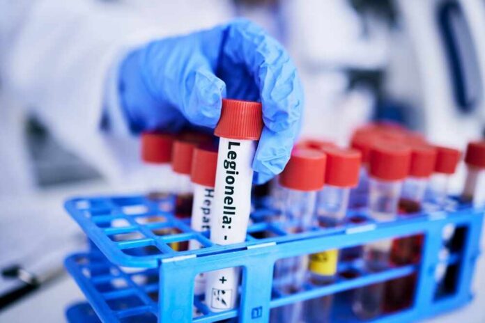 A gloved hand holding a test tube labeled 'Legionella' among other samples