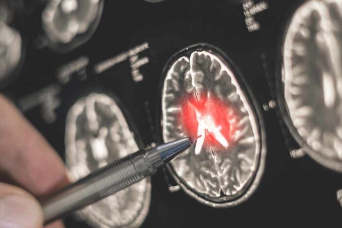 A hand pointing at a brain scan with highlighted areas