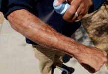 Mayo Clinic Minute (Q and A): Sunscreen Best Practices Mayo Clinic Minute - What type of sunscreen should you use?