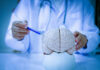 Dementia Map Stuns Researchers A doctor pointing at a brain model with a pen