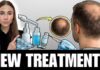 New Hair Loss Treatments in 2026 | Dermatologist Explains What Actually Works