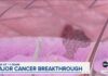 New cancer vaccine shows promise in extending life span in late-stage trial
