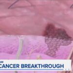 New Cancer Vaccine Stuns — Wall Street Surges New cancer vaccine shows promise in extending life span in late-stage trial