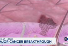 New cancer vaccine shows promise in extending life span in late-stage trial