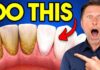 The #1 BEST Remedy for Dental Plaque (TARTAR)