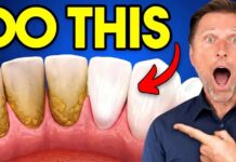 The #1 BEST Remedy for Dental Plaque (TARTAR)