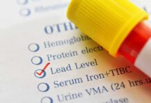 Blood sample tube on lab test form with lead level checked