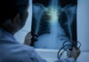 Marfan Syndrome: Tiny Bulge, Massive Risk Doctor examining a chest X-ray with a stethoscope in hand