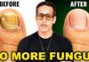 Eliminate Toenail Fungus FAST — Do This Every Night