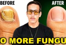 Eliminate Toenail Fungus FAST Eliminate Toenail Fungus FAST — Do This Every Night